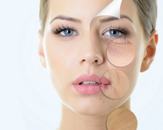 Sun Damage Survey