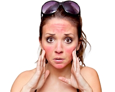 Sun Damage Survey