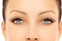 Eyelid rejuvenation