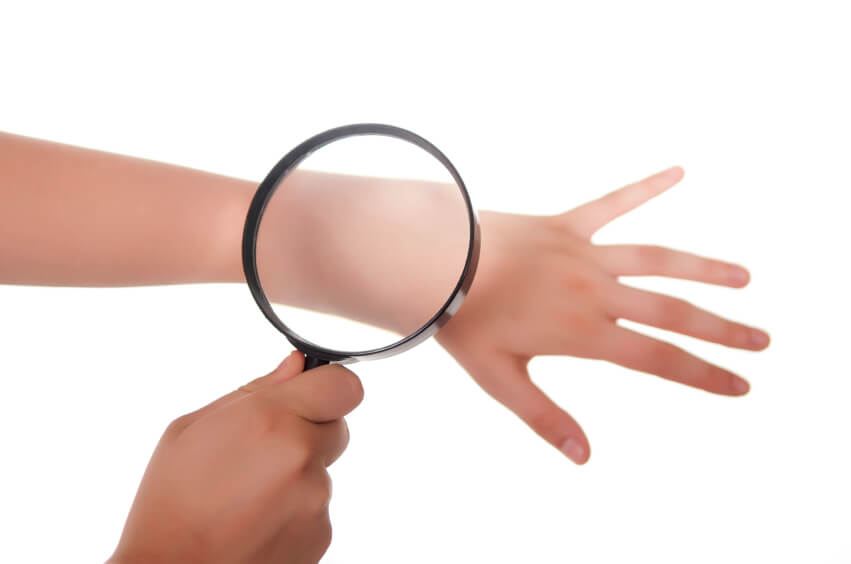 Sun Damage Survey
